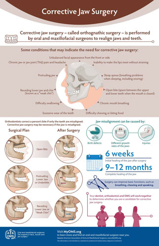 08_corrective_jaw_surgery_tile